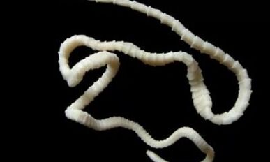 hogyan lehet eltávolítani a cestoda parazitát a szervezetből