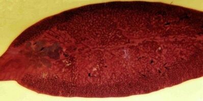 trematoda parazita hogyan kell eltávolítani a szervezetből